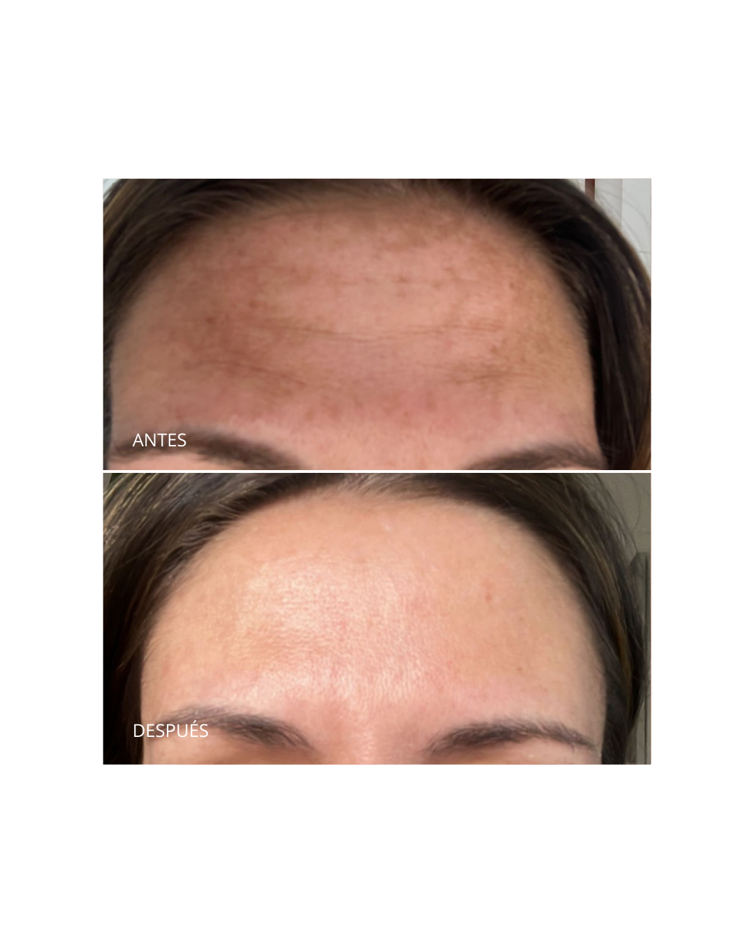 Pack Despigmentante. Dermamelan