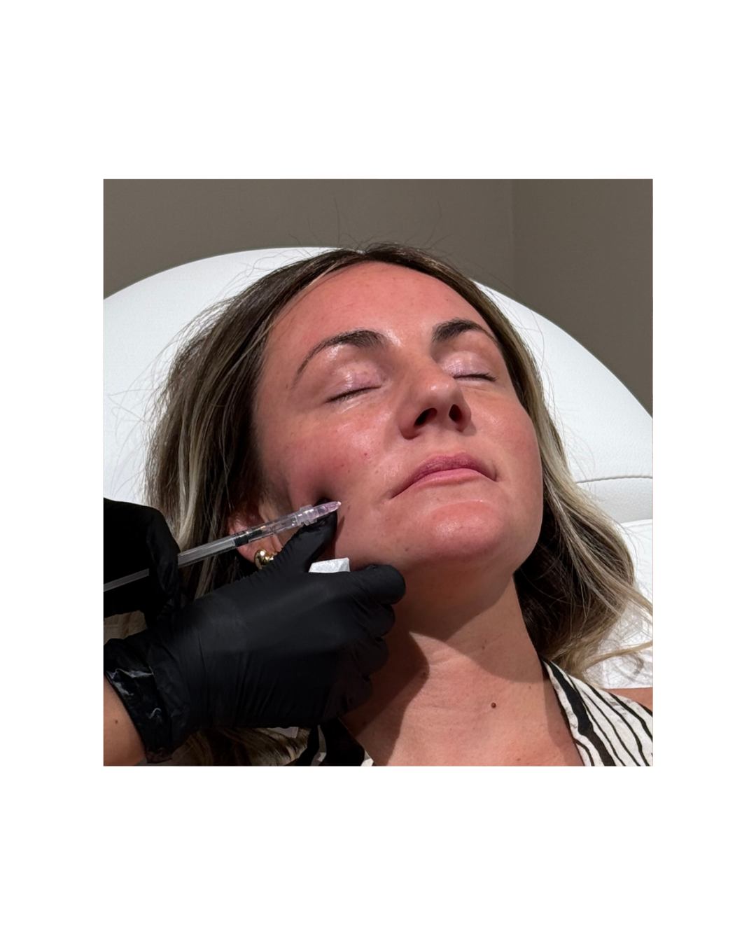 Inductor de colágeno